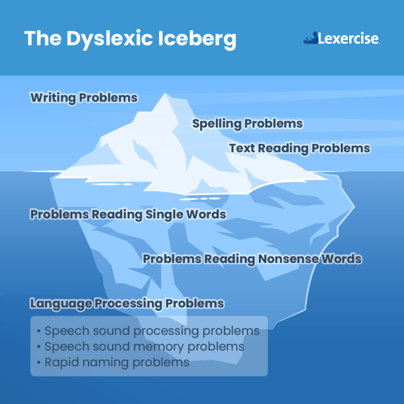 Dyslexia Iceberg infographic shows the layers of language processing problems 