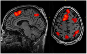 FMRI_scan_during_working_memory_tasks